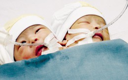 Cháu bé hai đầu đã thoát khỏi tình trạng nhiễm trùng máu nặng